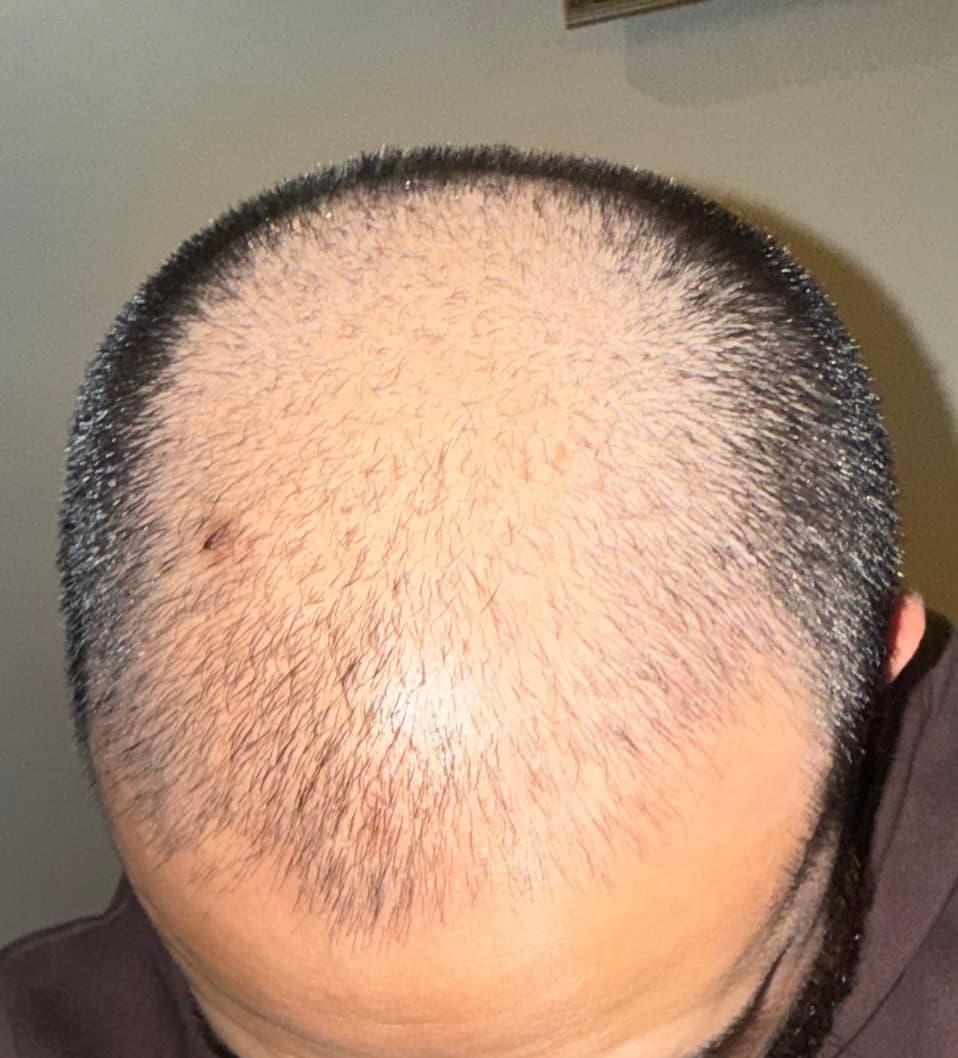 Before and after result 1